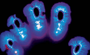 Kirlian photograph of human fingertips